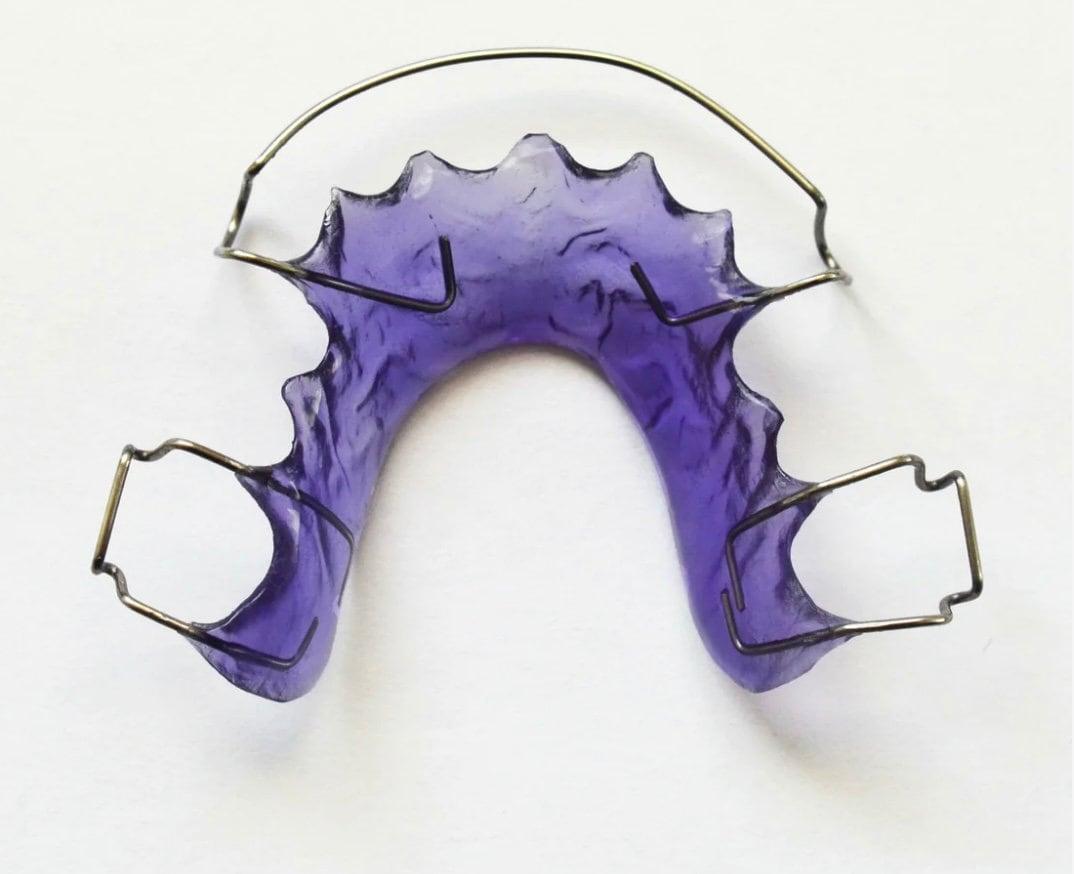 Orthodontic Retainer adams clasp