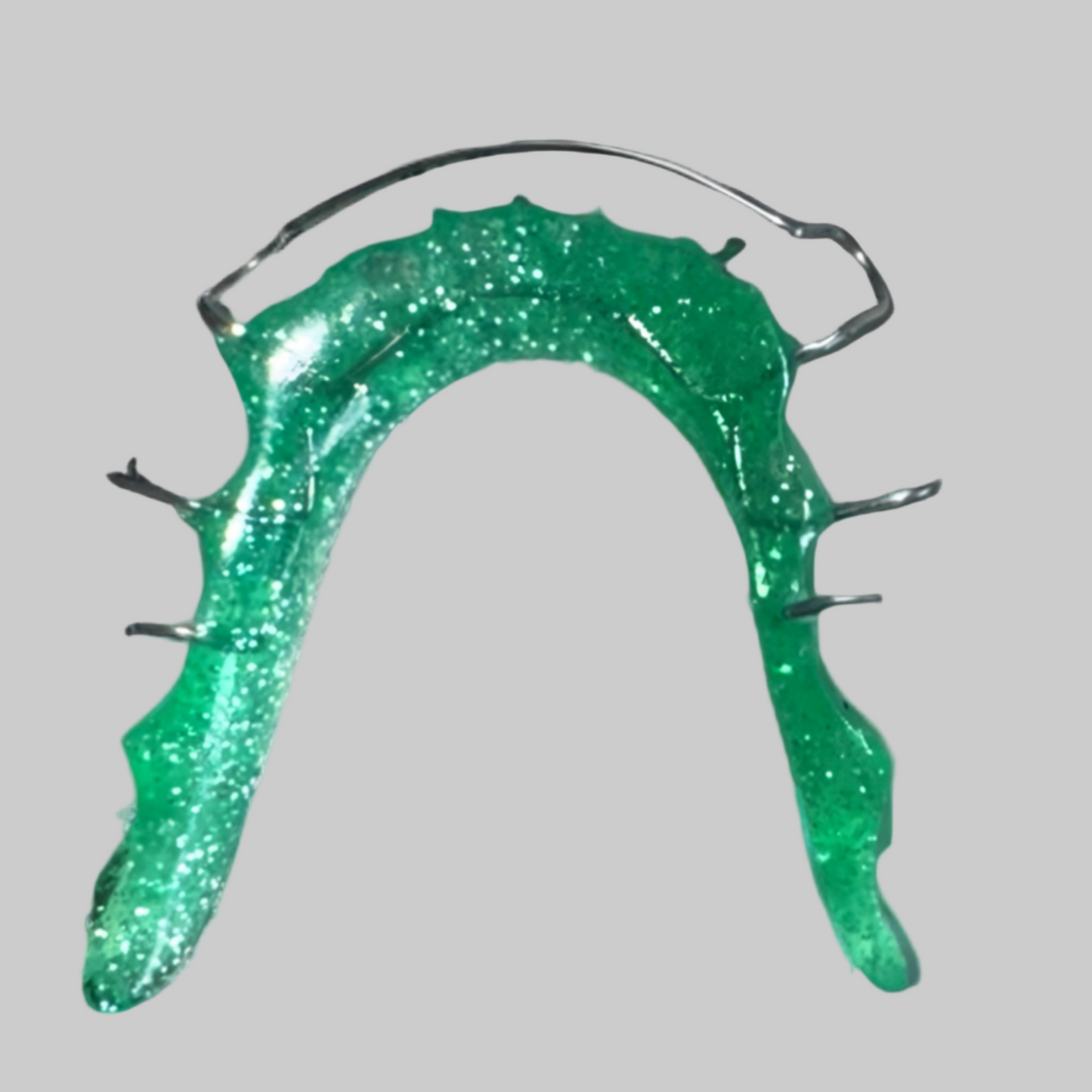Custom Lower Hawley Retainer with Green Glitter Acrylic – Durable and Stylish Orthodontic Appliance"
