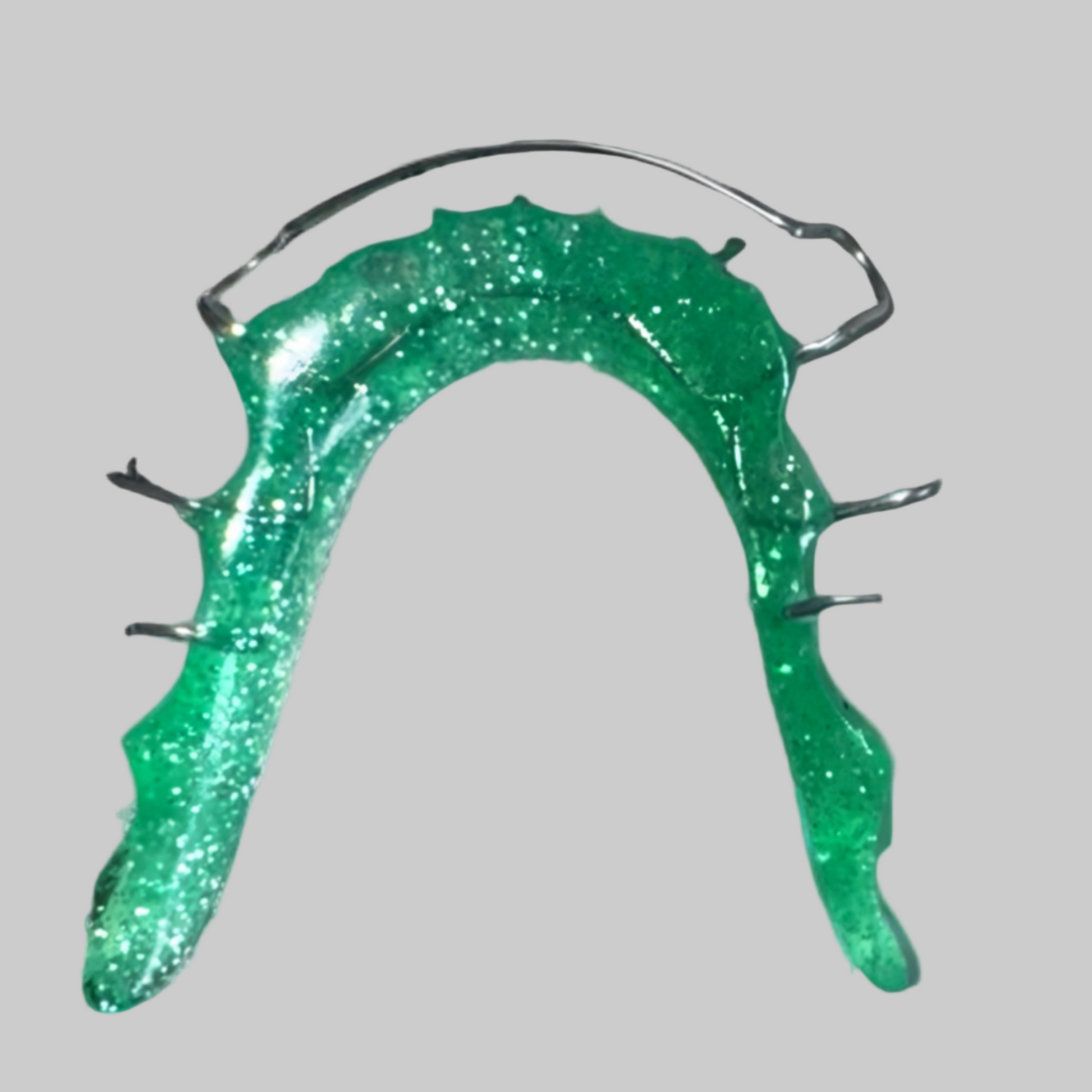 Custom Lower Hawley Retainer with Green Glitter Acrylic – Durable and Stylish Orthodontic Appliance"