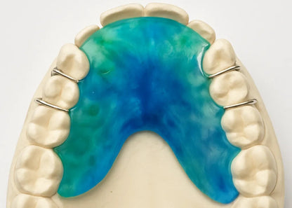Dental model with blue tie dye upper retainer 