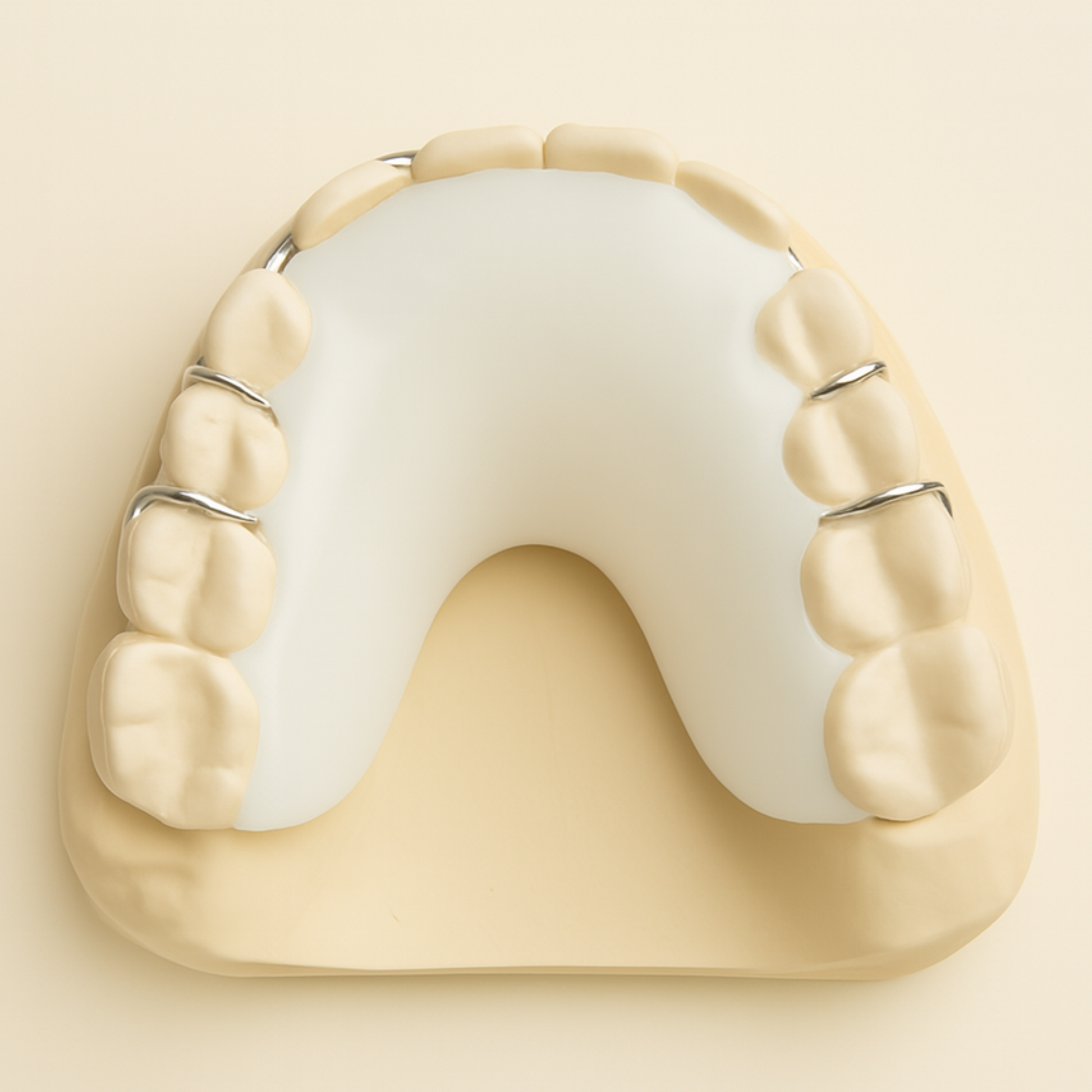 Sleek White acrylic on upper retainer 