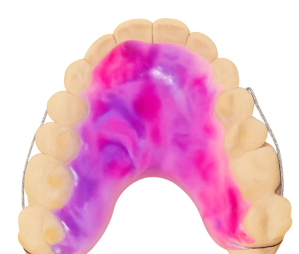 Dental model with pink and purple acrylic applied to it