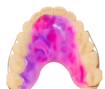 Dental model with pink and purple acrylic applied to it